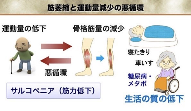 筋萎縮と運動量減少の悪循環