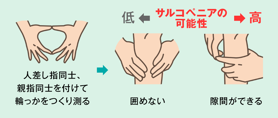 サルコペニア：指輪っかテスト